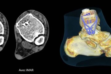 Centre de Radiologie Ennakhil a Beni Mellal