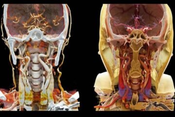 Centre de Radiologie Ennakhil a Beni Mellal