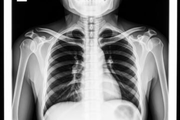 Radiographie Pédiatrique : Comment Préparer Votre Enfant