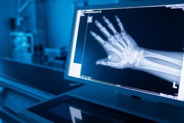 Radiographie de la Main au Maroc : Prix, remboursement et guide pratique