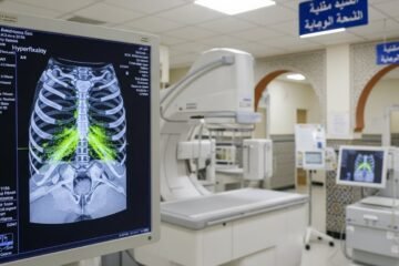 Scintigraphie pour algodystrophie au Maroc : Prix, Déroulement et Remboursement (Guide Complet 2026)